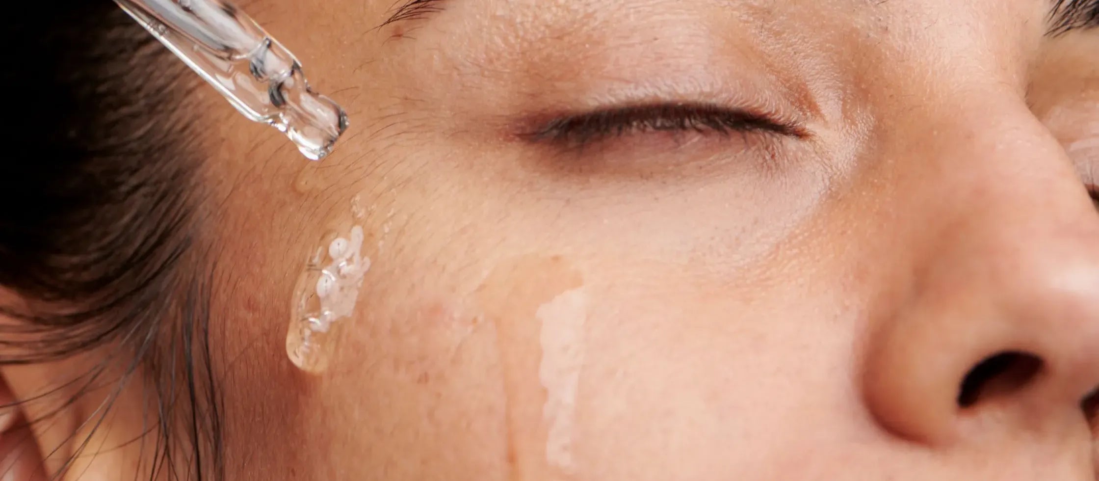 A collection of effective acne serums designed specifically for dry skin, showcasing their packaging and textures.