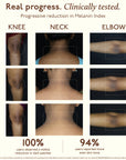 Tone Restore Knee-Neck-Elbow Cream