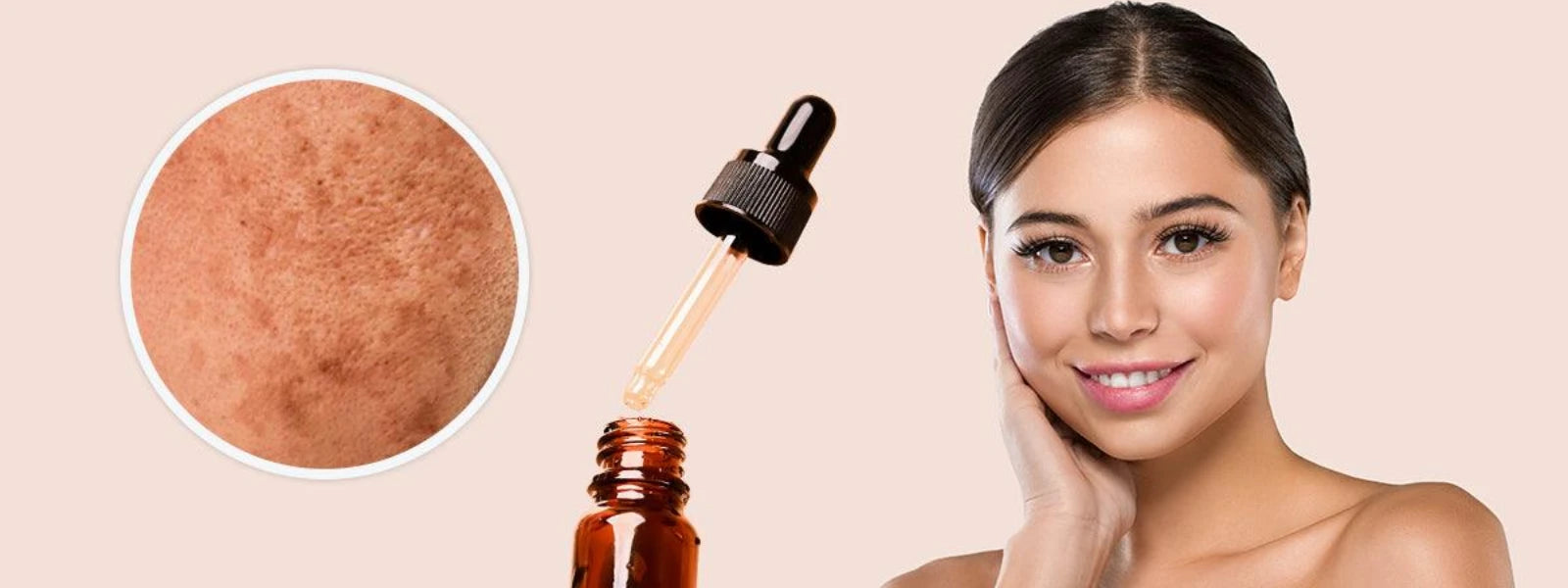 10 Clinically Formulated Pigmentation & Acne Solutions 