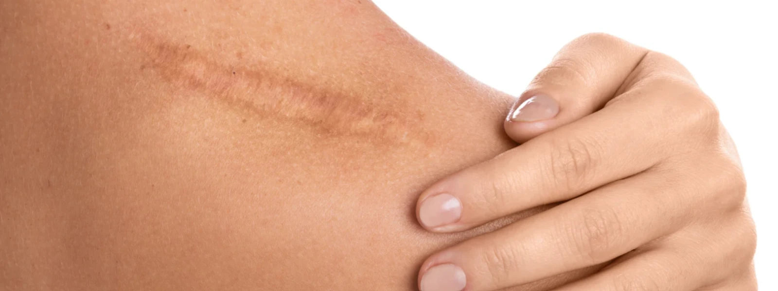 11 Humid Tips to Strengthen Your Skin Barrier 