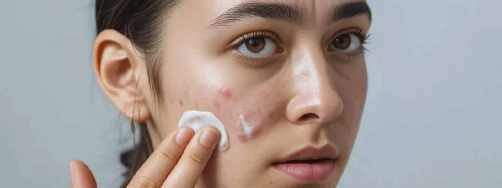 11 Natural Remedies for Hyperpigmentation Causes & Dark Spots 