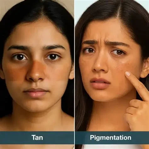 A woman applying a natural face pack, illustrating how to treat tanning naturally for Indian women. 