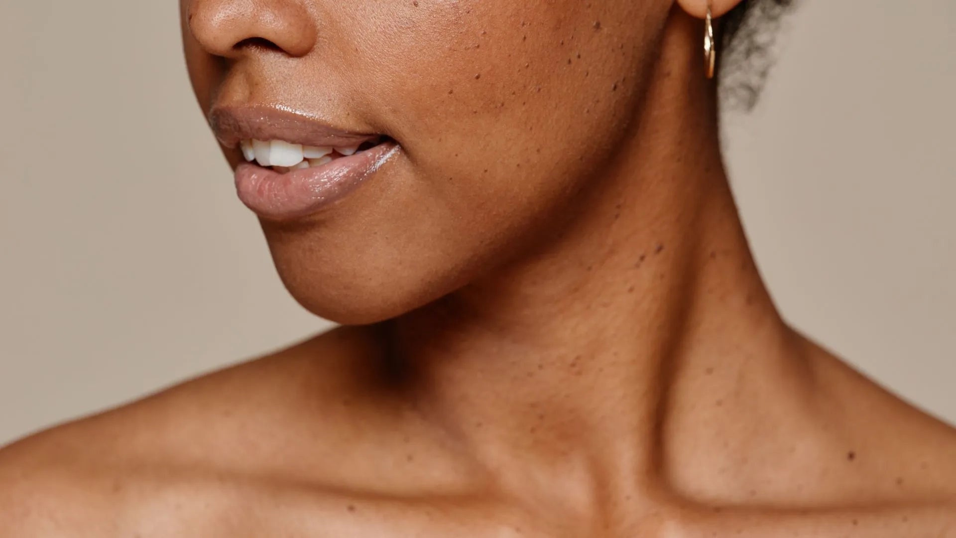 Effective Methods to Diminish Hyperpigmentation: A Comprehensive Guide