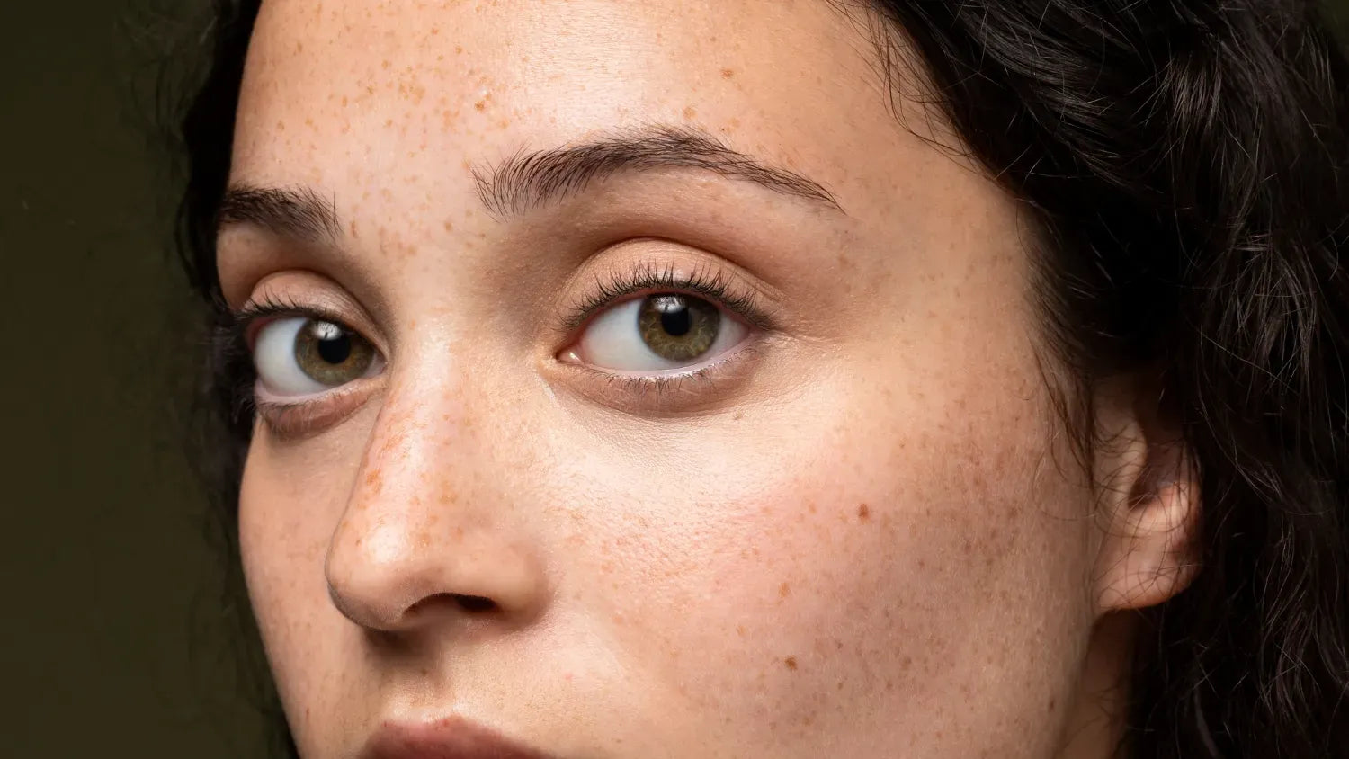 Understanding Pigmentation: Causes, Treatment, and Expectations