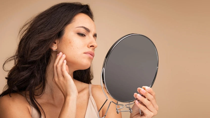 Retinol Skincare: Moisture Solutions for Combatting Dry Skin