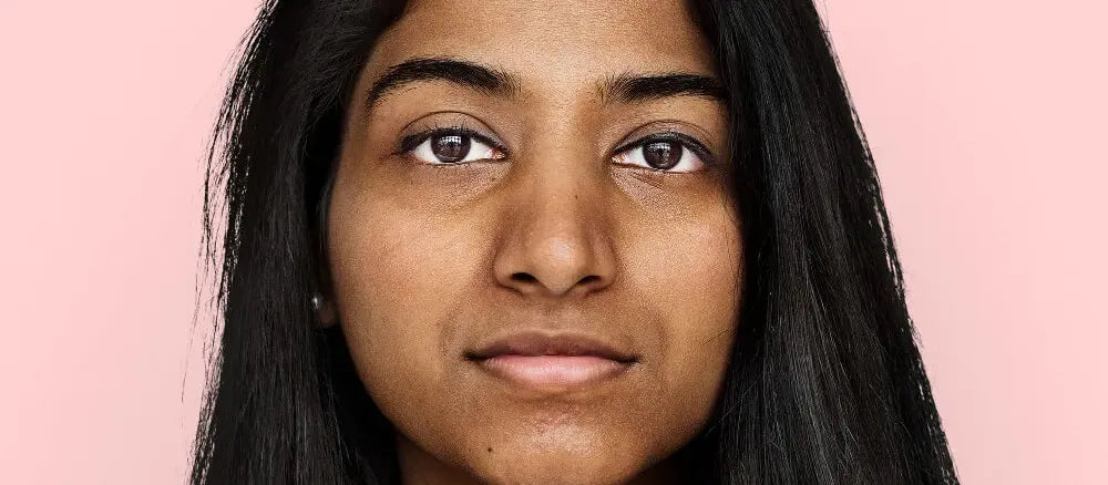 A woman applying sunscreen to her face, focusing on areas affected by melasma and hyperpigmentation.