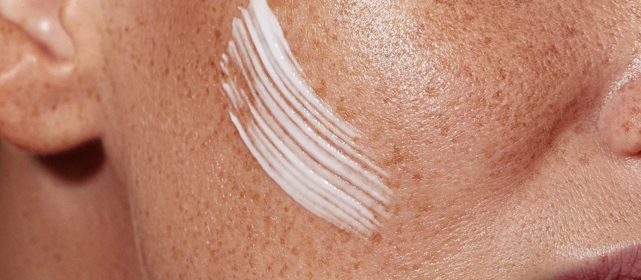 A person applying SPF 50 sunscreen on sensitive skin, showcasing sun protection and skincare awareness.
