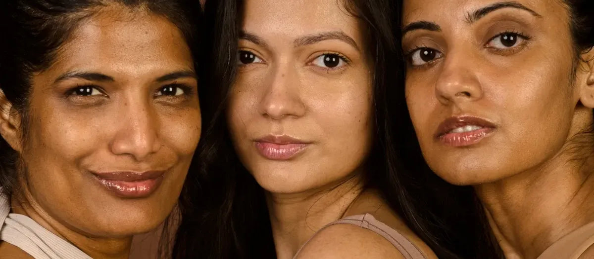 A gentle face wash bottle designed for acne marks on dry skin, showcasing its hydrating and soothing formula.