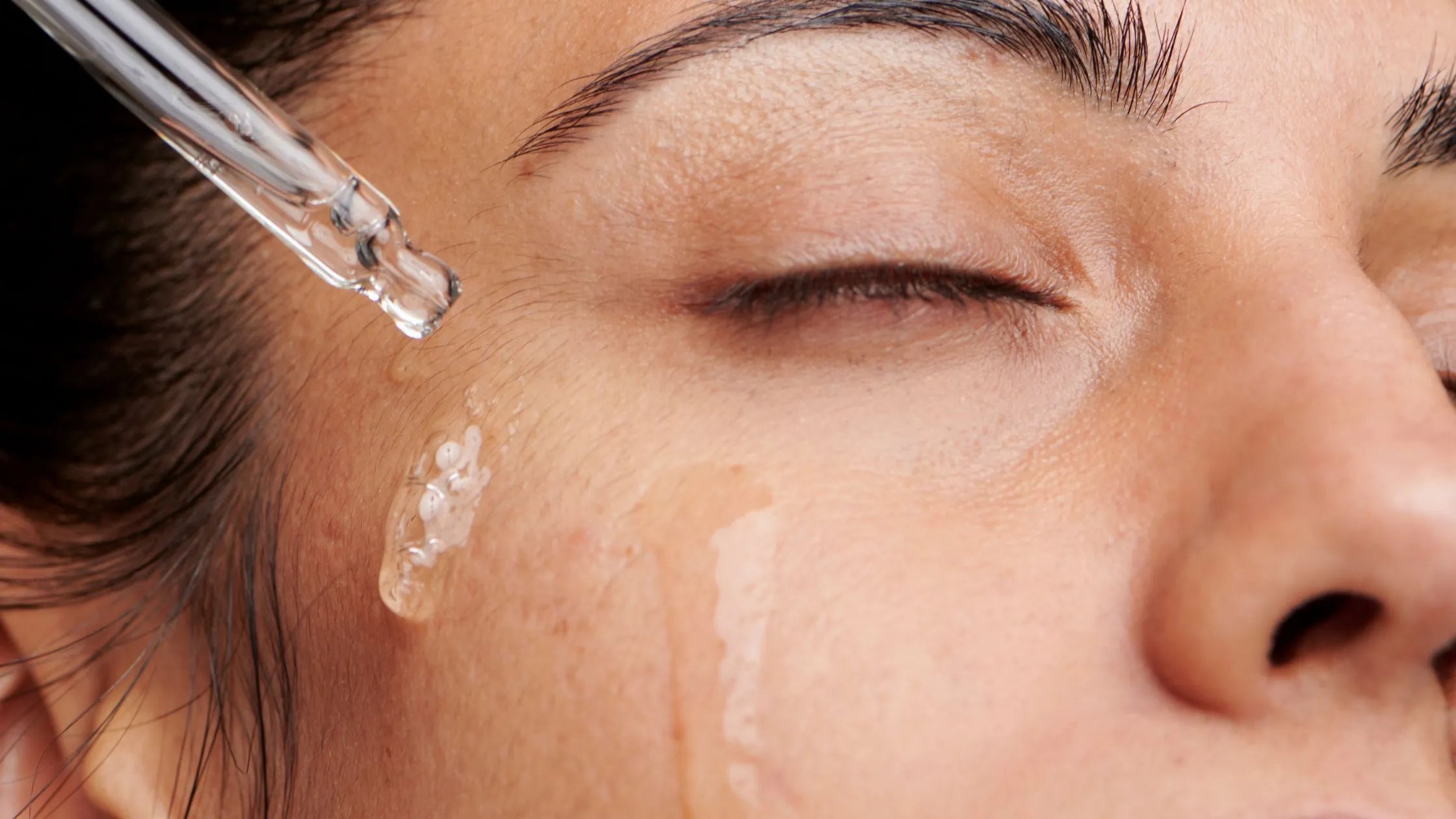 A woman applying anti-acne serum for radiant, clear skin, showcasing the product's effectiveness.
