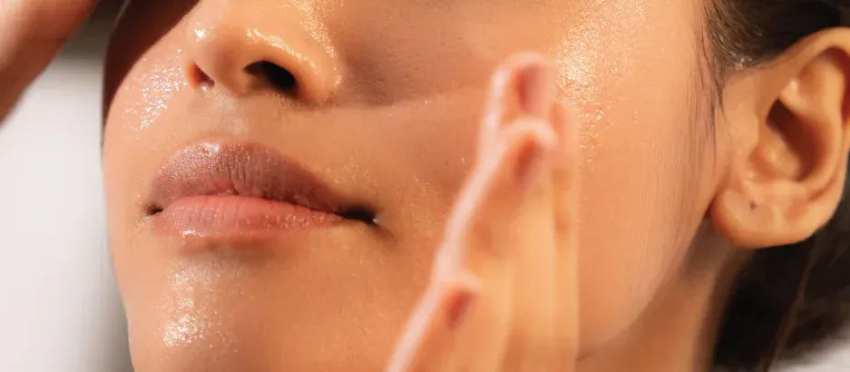 A bottle of anti-acne serum surrounded by clear skin products on a marble countertop.