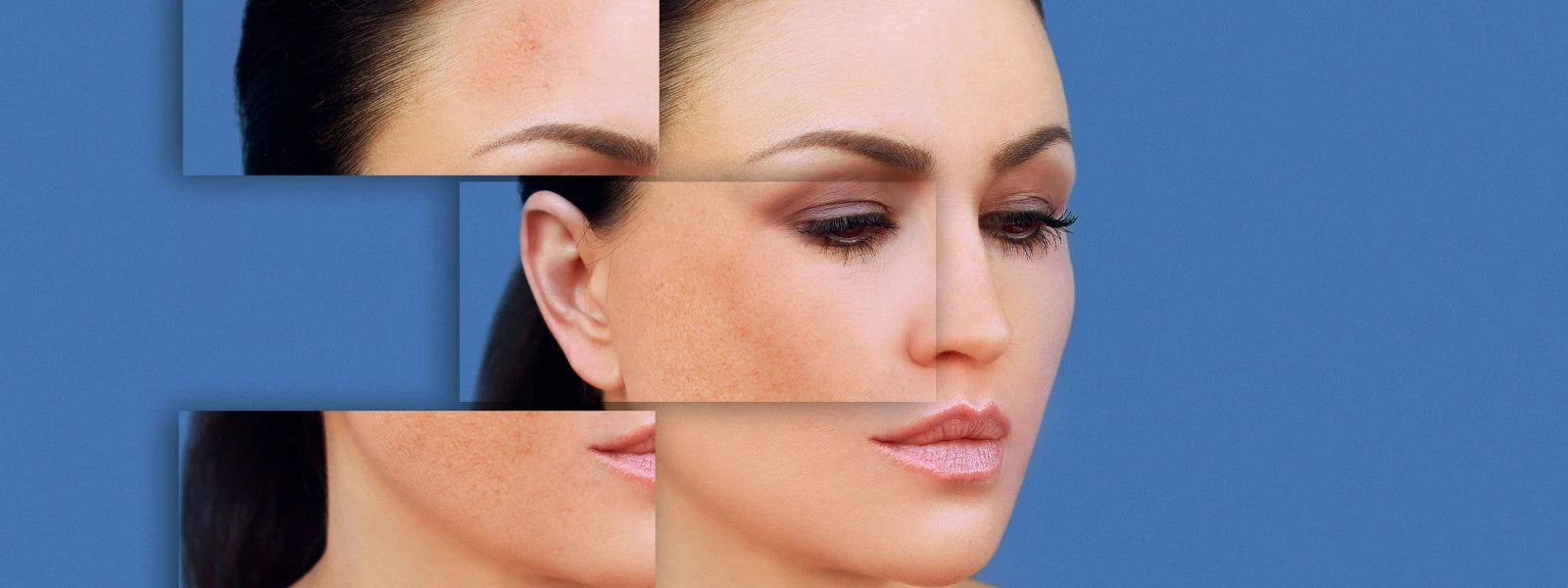 5 Secrets: Shrink Pores, Stop Acne Fast 