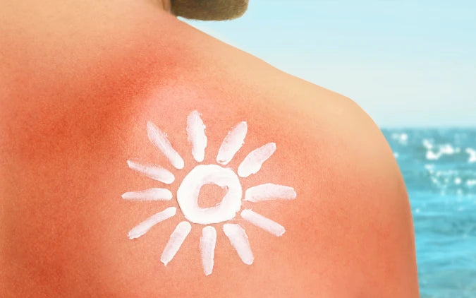 Protecting skin from sun damage with sunscreen and healthy habits. 