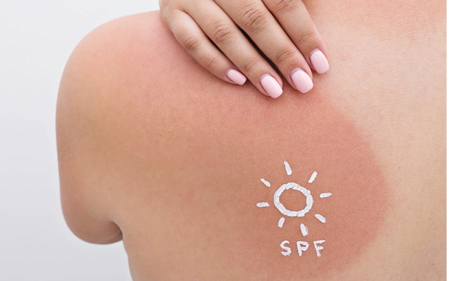 Diagram showing skin cell changes during the tanning process, including melanocytes producing melanin. 