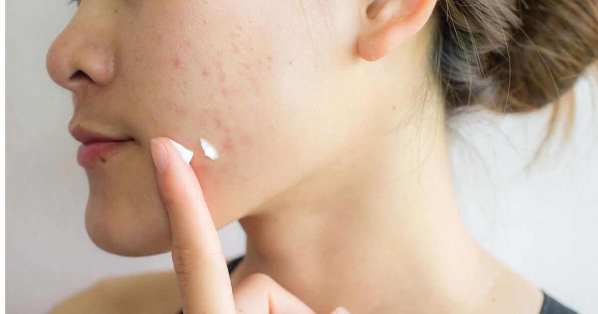 13 Ways Climate Control Skin Boosts Barrier Repair 