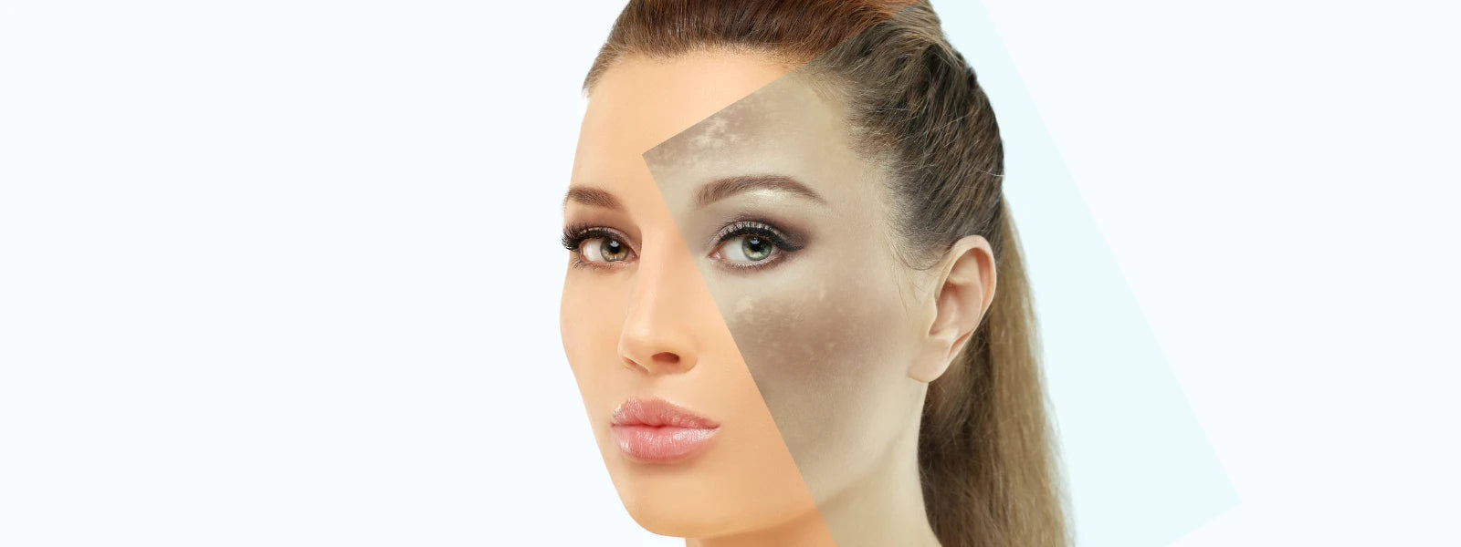 Reasons for skin darkening, hyperpigmentation, and prevention tips explained. 