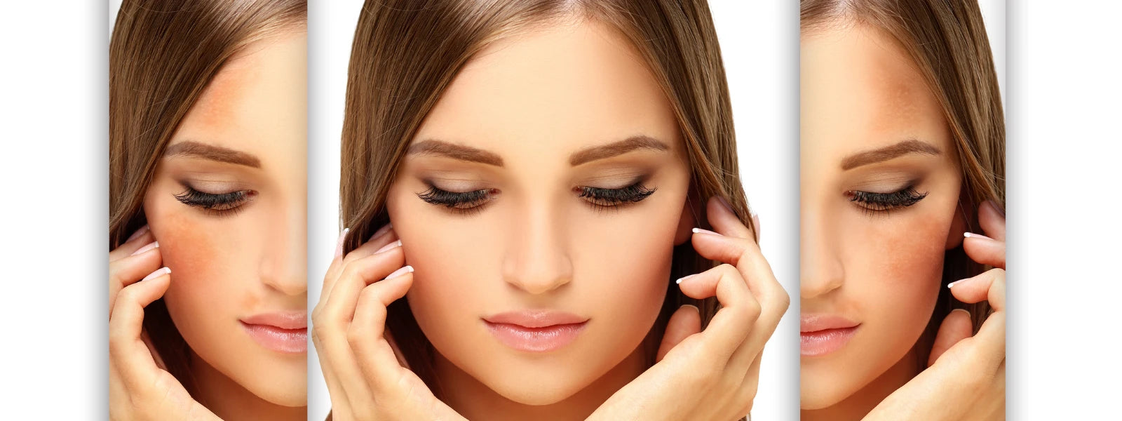 How UV Rays Affect Skin: Understanding Sun Damage 