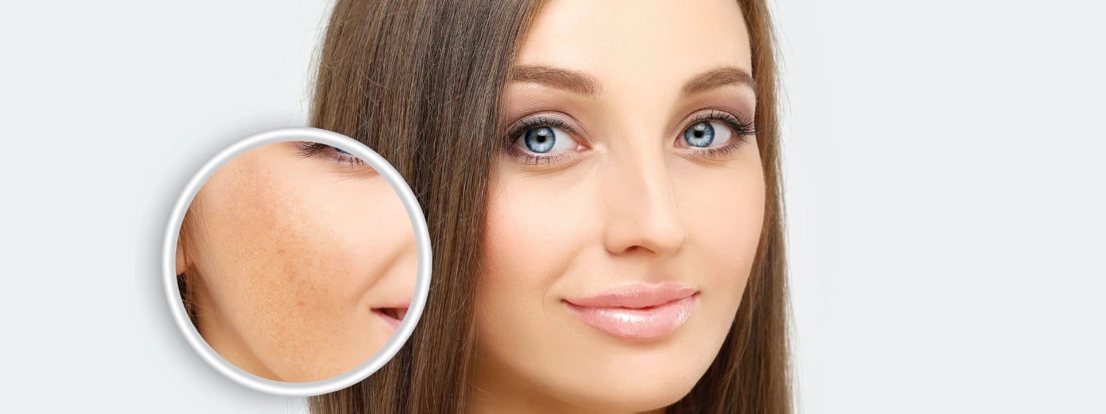 How to Treat Dark Spots on Indian Skin Effectively – World of Asaya