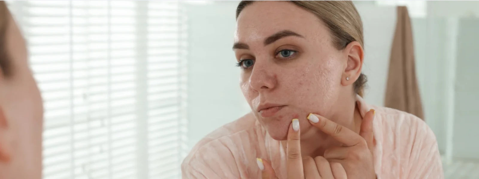 Teen with acne looking at mirror, concerned about spots 