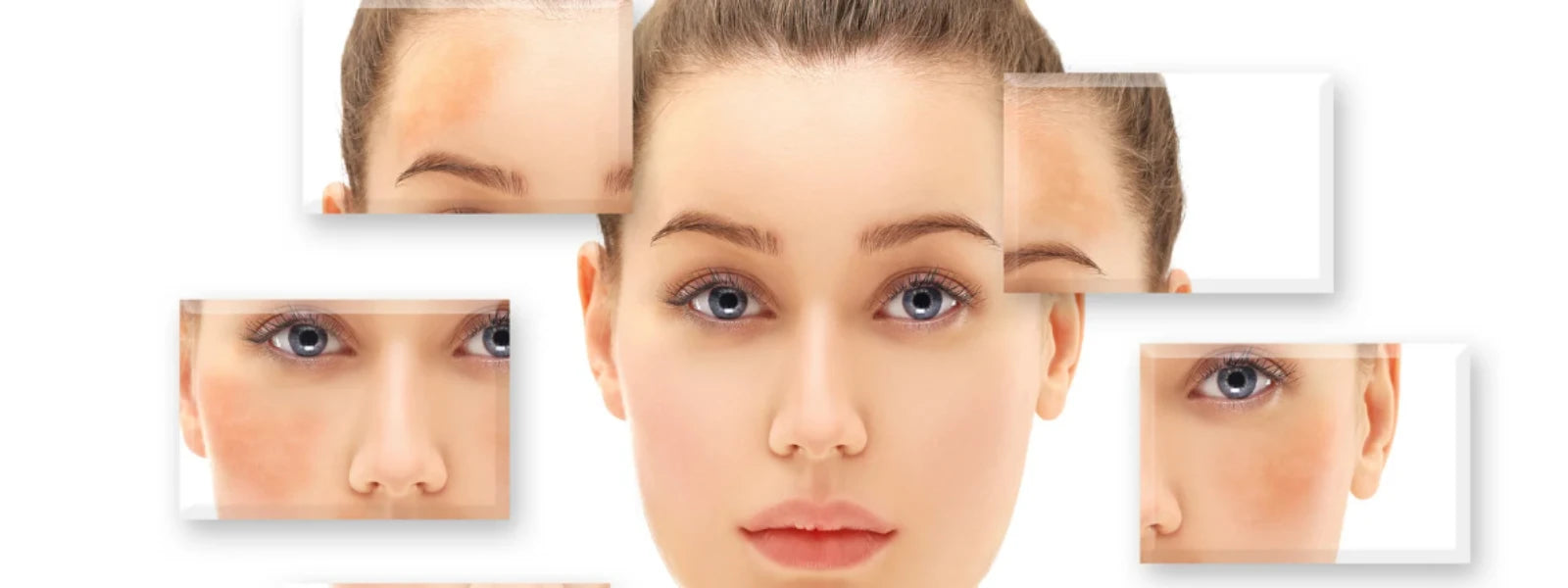 Hyperpigmentation Naturally (1).webp 