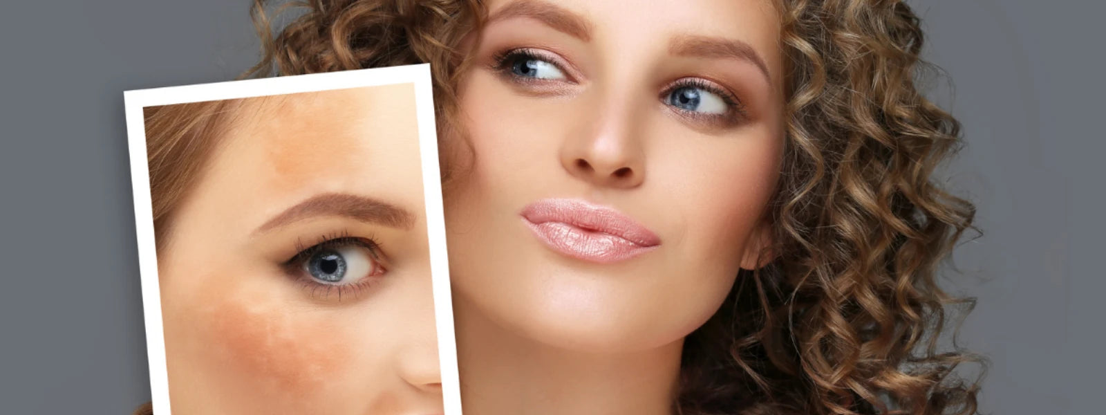 Hyperpigmentation ingredients: fade dark spots for radiant skin. 