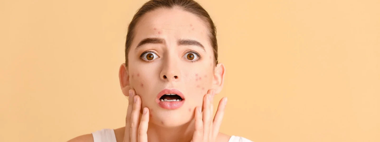 Hyperpigmentation Naturally (6).webp 