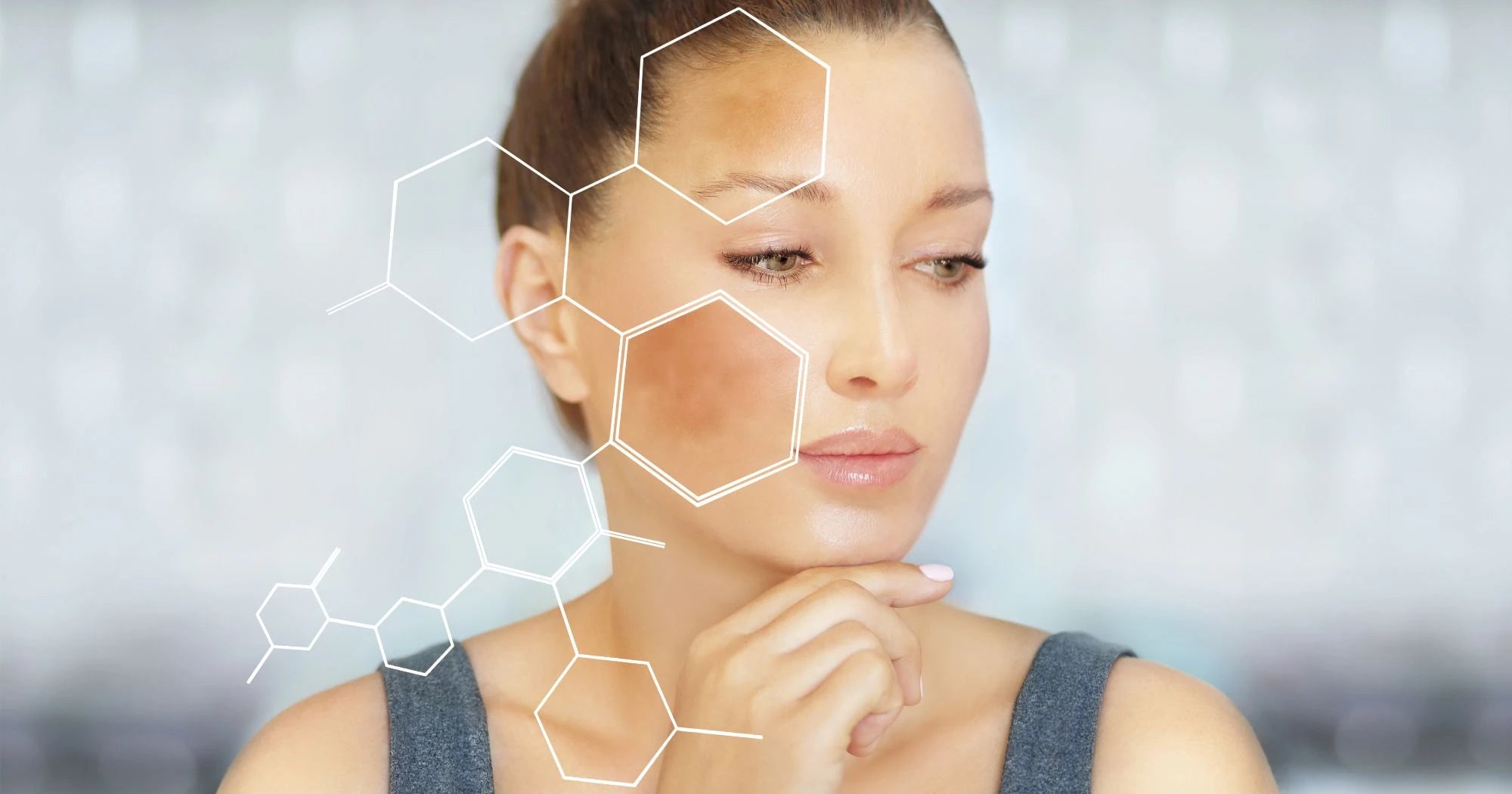 A woman's face showing fading dark spots, illustrating why dark spots reappear. 