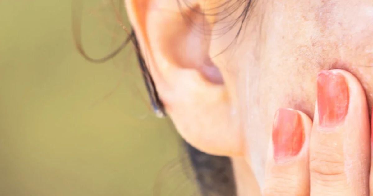 Essential Checklist for Preventing Dark Spots This Monsoon 