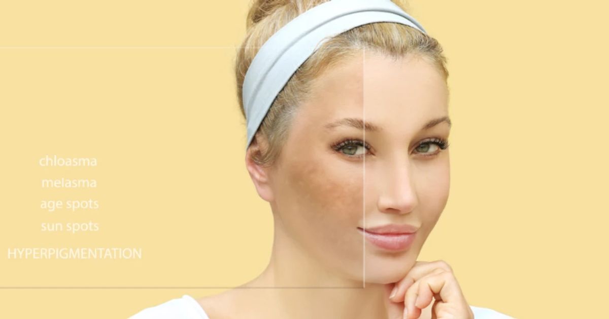 Step-by-Step Guide to Clearing Dark Neck for Gen Z 