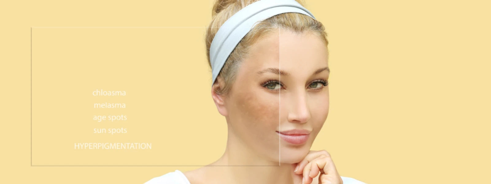A checklist graphic for city sun hyperpigmentation treatment, with icons for sunscreen and skincare. 