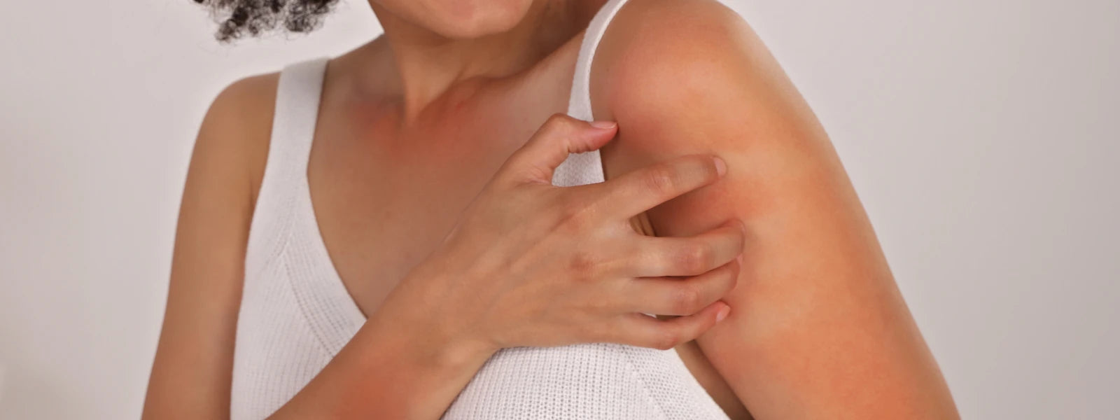 A comparison image showing the difference between red, irritated reactive skin and raised hives from a skin allergy. 