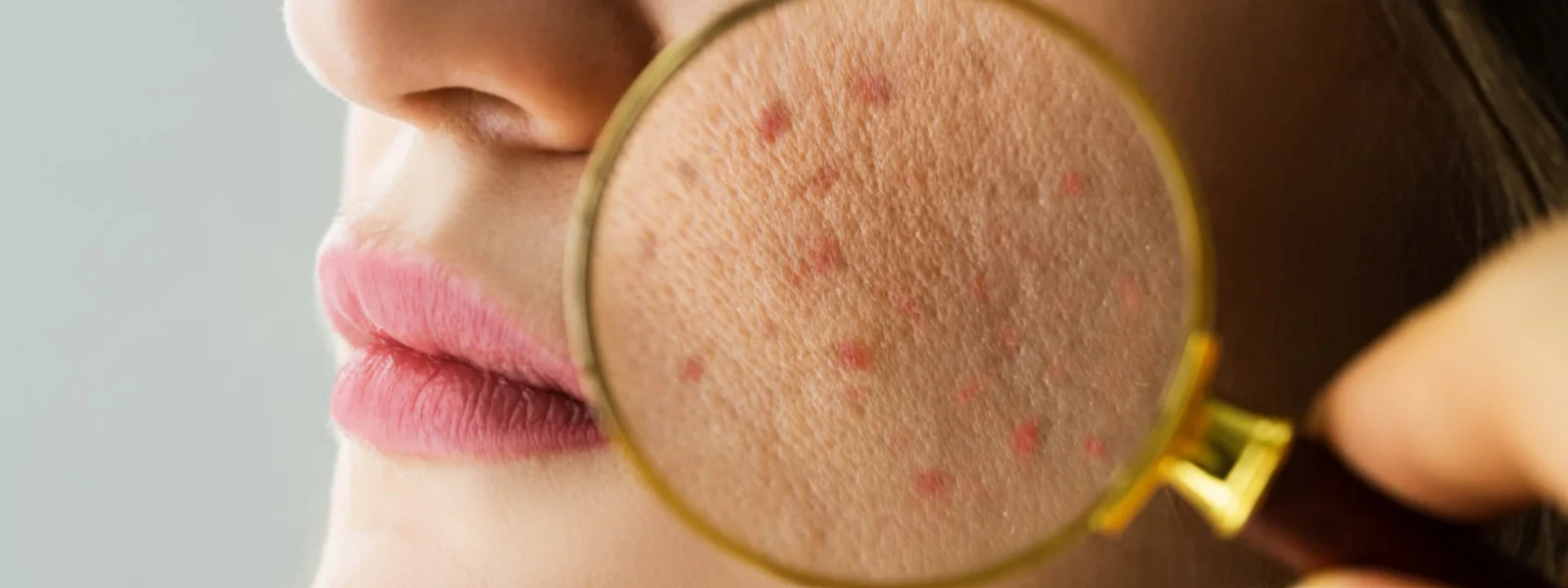 Pigmentation(10).webp 