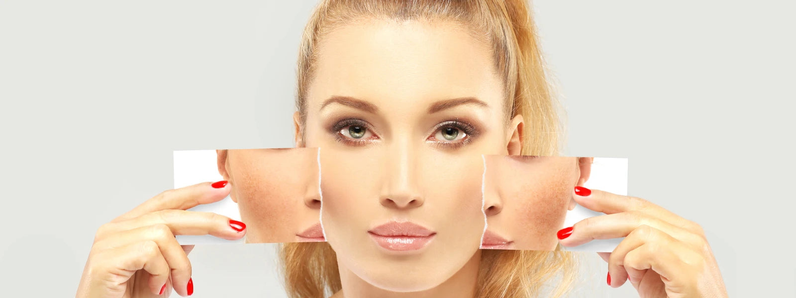 DarkSpots(3).webp 