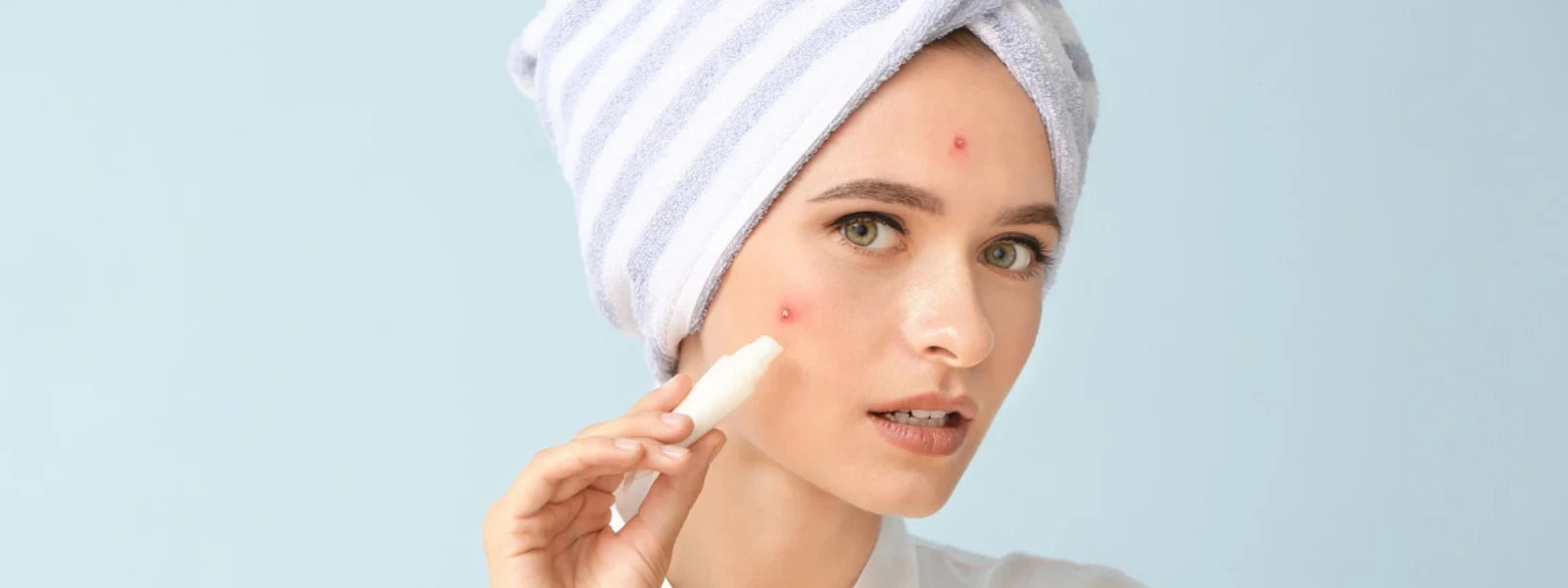 Best Sunscreens for Acne and Dark Spots.webp 