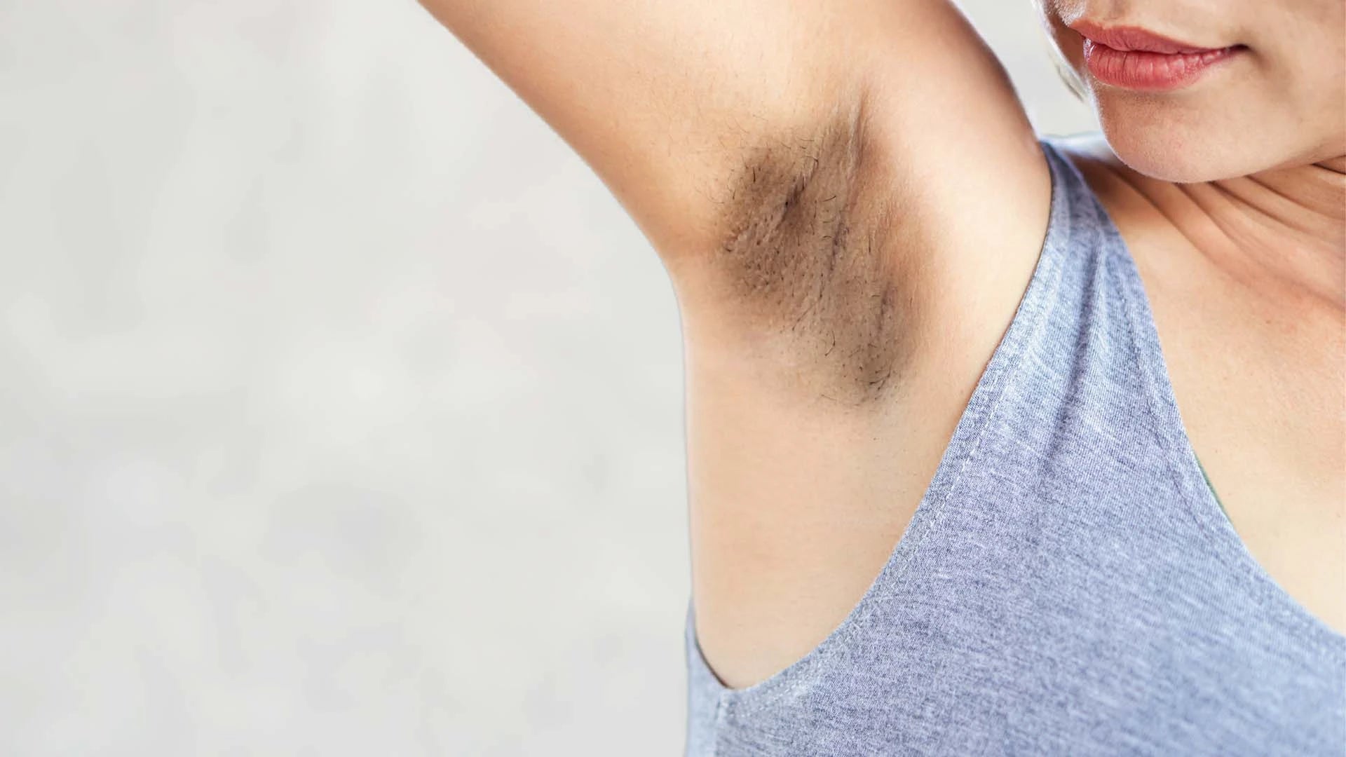 Dark Underarms on Brown Skin FAQ: Best Moisturizers & Treatments 