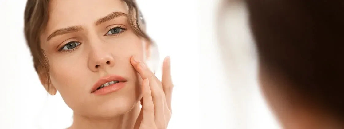 Early Melasma Signs: What You Need to Know 