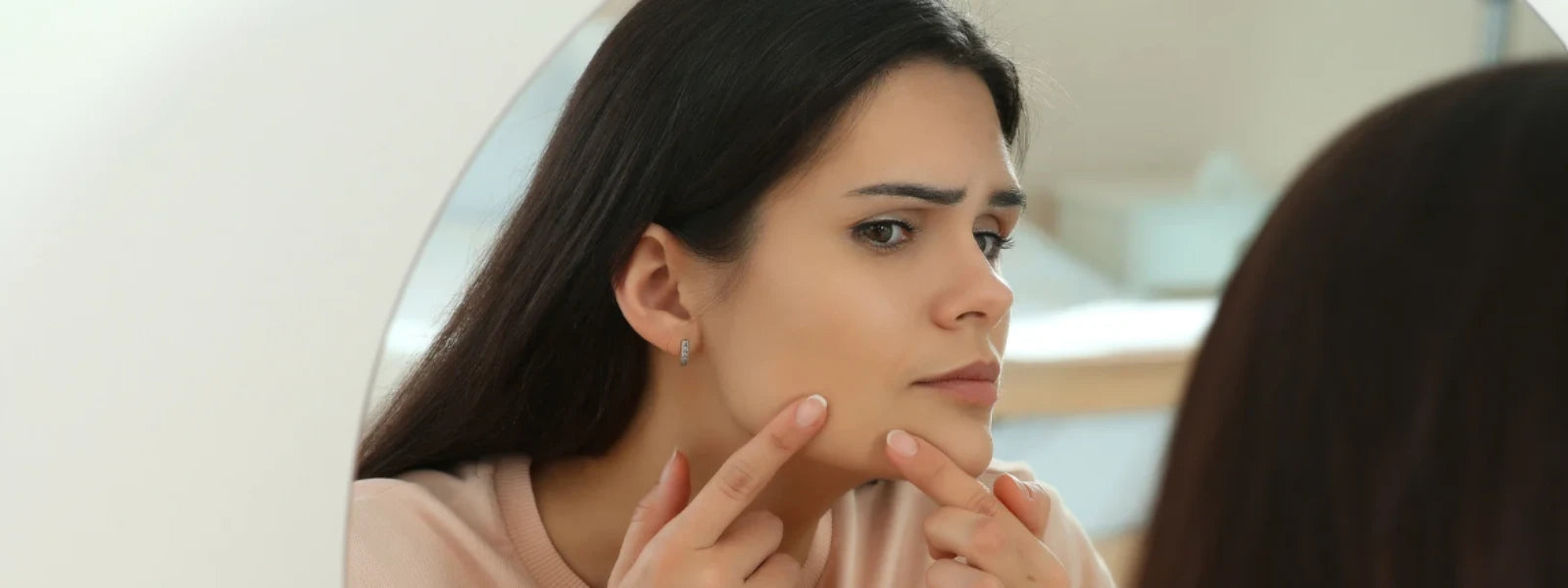 Essential Checklist: Identifying Hormonal Acne Causes 