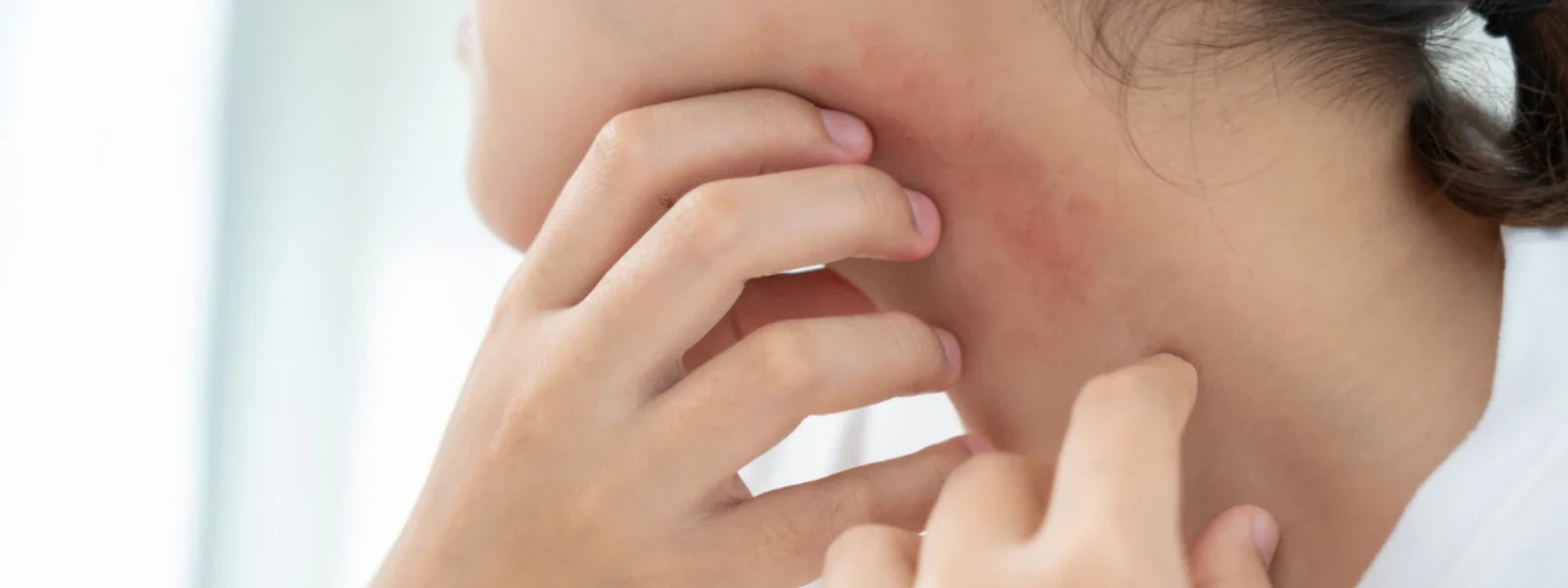Essential Checklist: Preventing New Skin Scars Now 