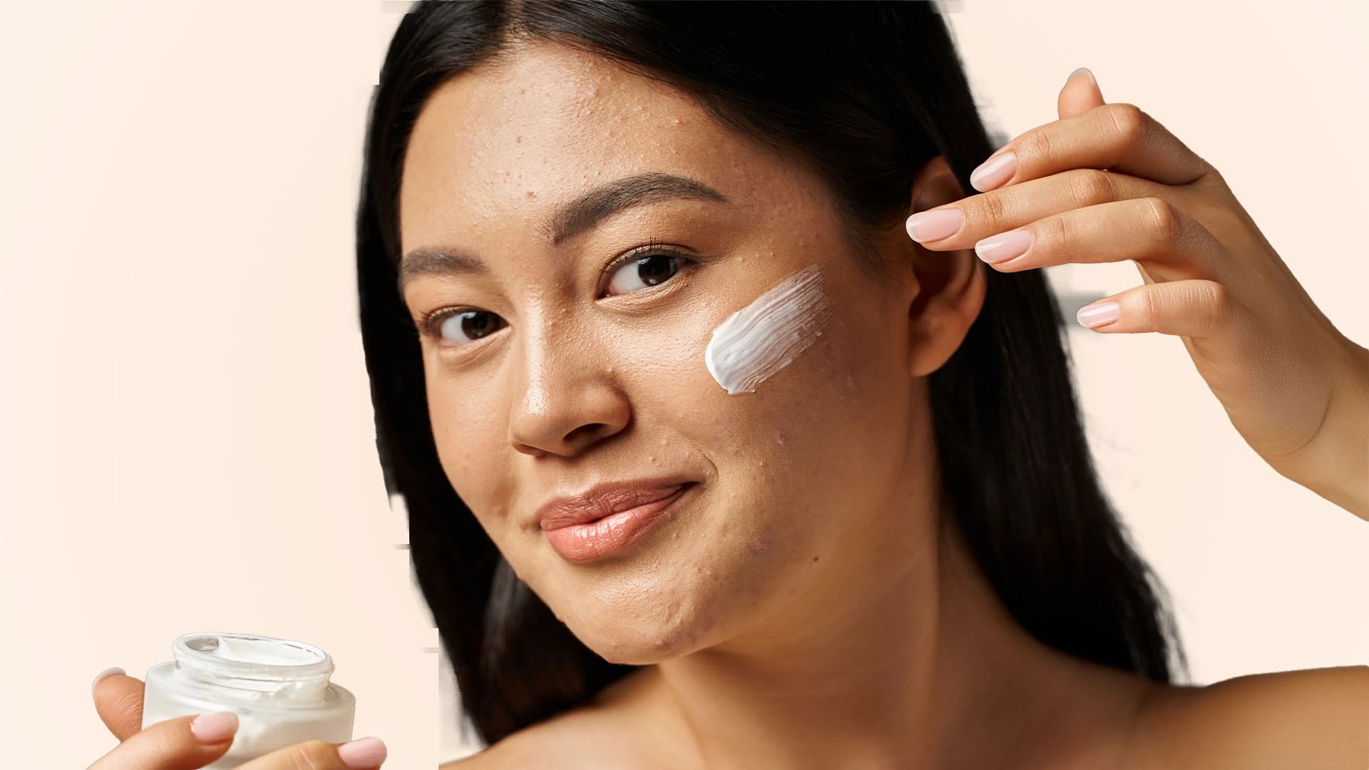 How to Manage Acne: Your Ultimate Skin Care Routine Guide 