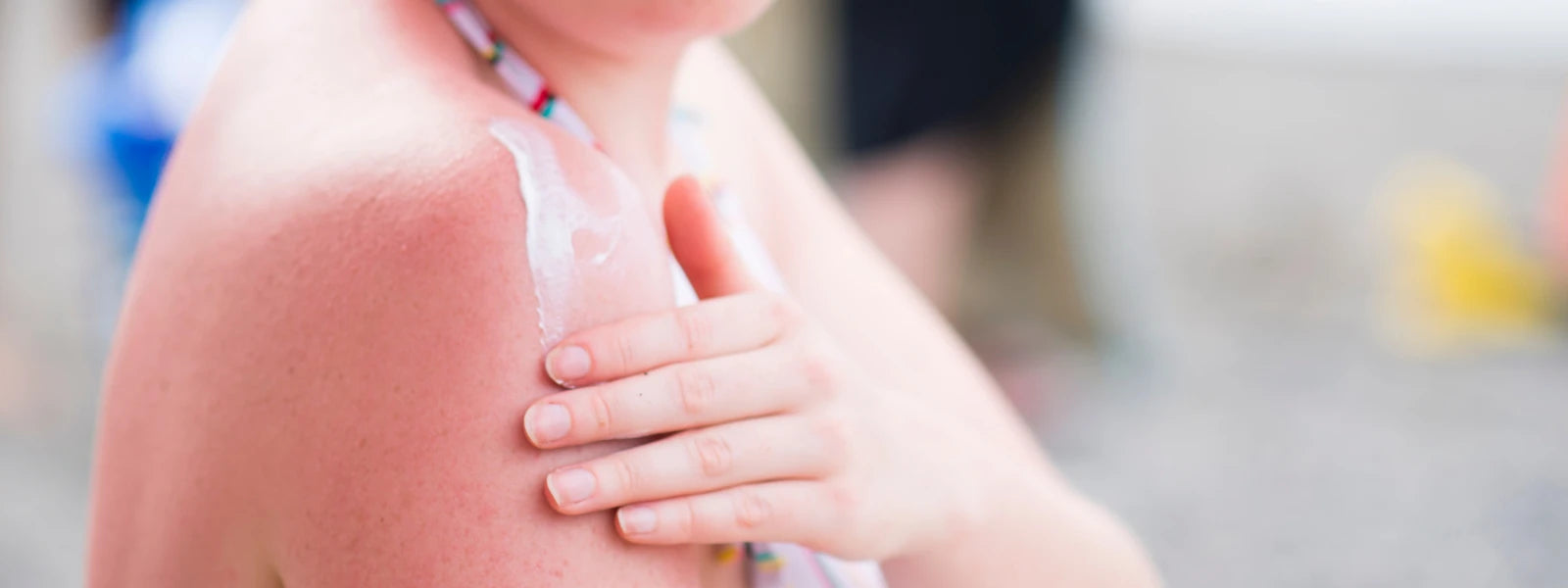 How to Prevent Tanning During Indian Summer: Expert Tips 