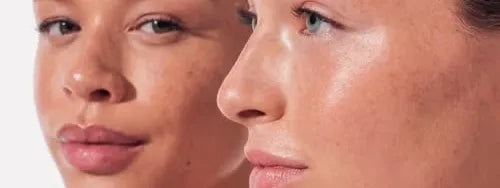 How to Tell Dehydrated Skin from Dry Skin Now 