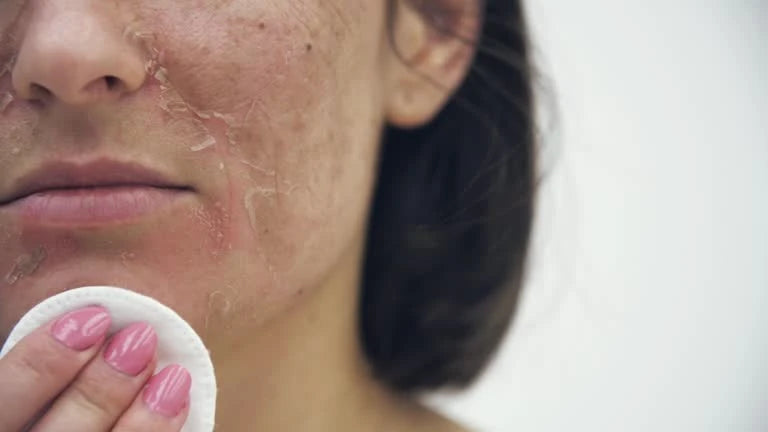 How to Tell Signs of Dry Skin: A Complete Tutorial 