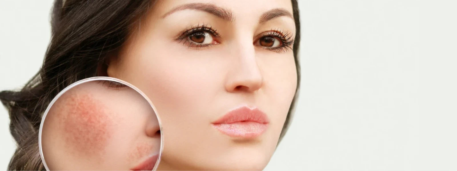 Hyperpigmentation 101: Skin Tone Treatment Guide 