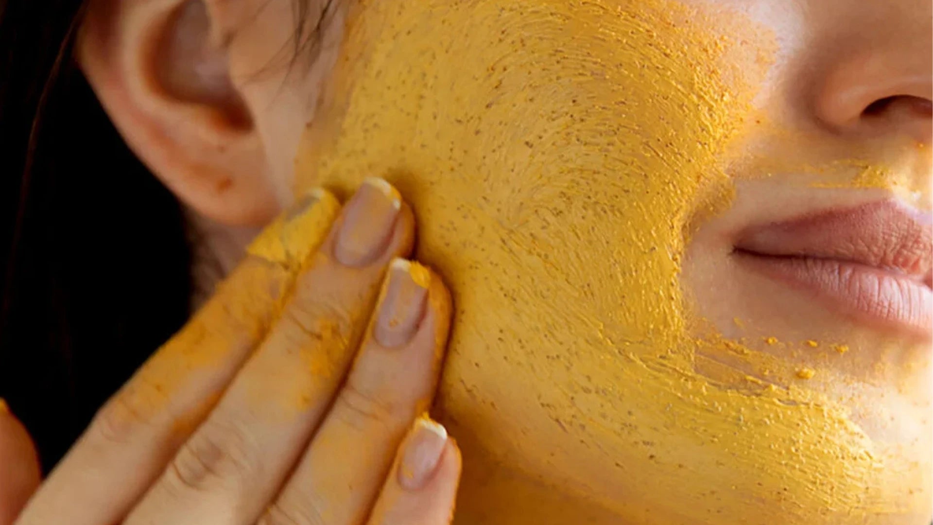 Hyperpigmentation Treatment vs. Natural Remedies: Which Fades Dark Spots Faster? 