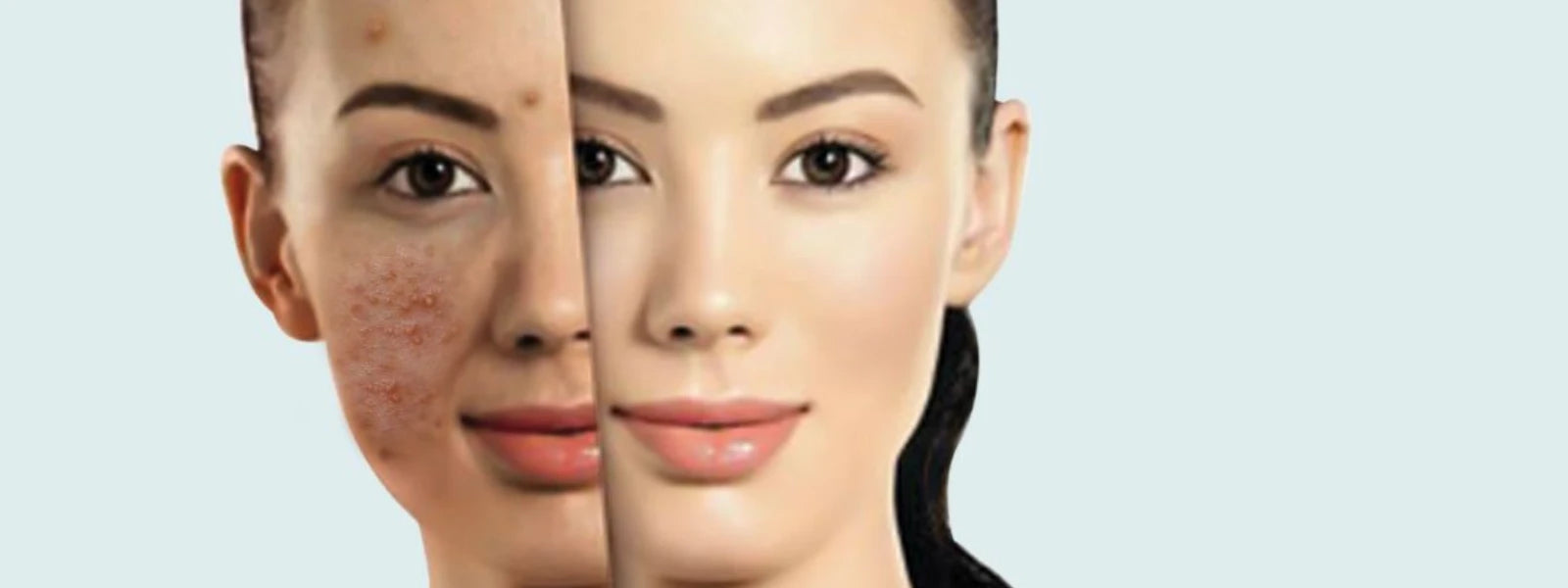 A person's clear, balanced skin with a backdrop of Mumbai's skyline, illustrating the Mumbai oily skin guide. 