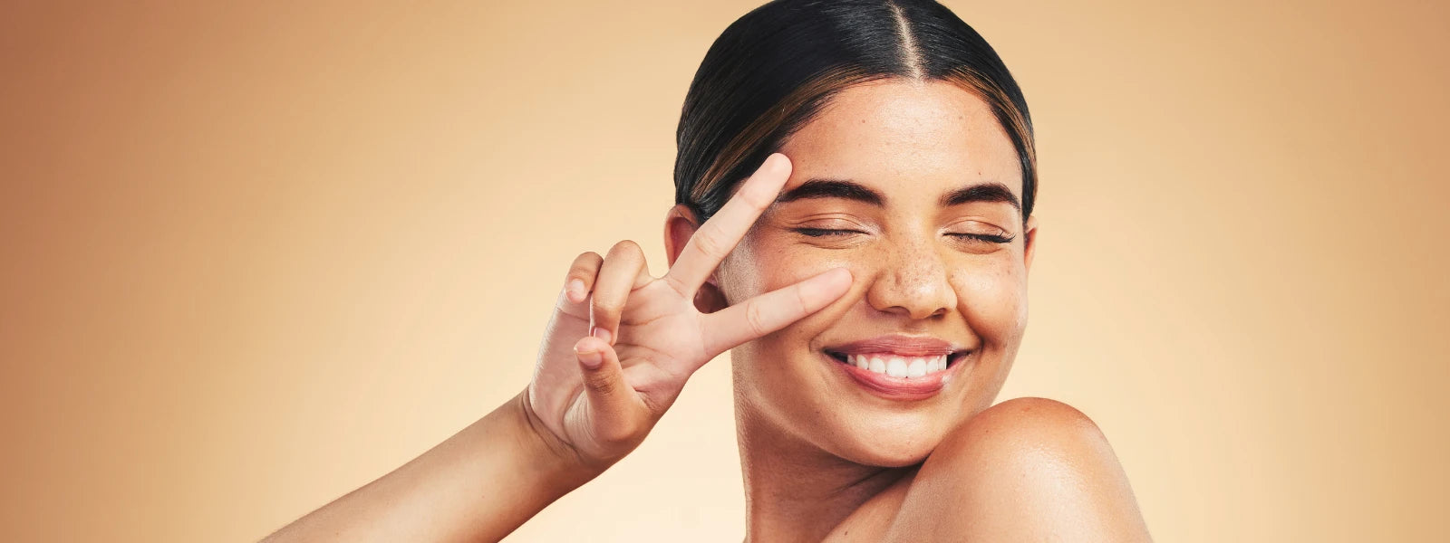 Melasma vs sunspots: identifying key differences in hyperpigmentation. 