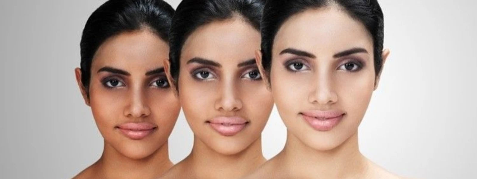 skinpigmentation(6).webp 