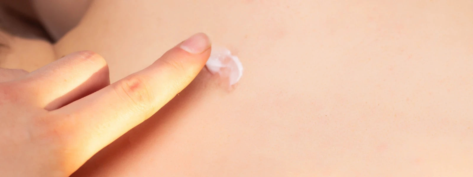 Scar Removal Checklist: 7 Essential Steps to Heal 
