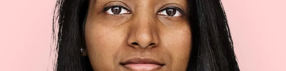 Skin Discoloration 101: Your Complete Guide 