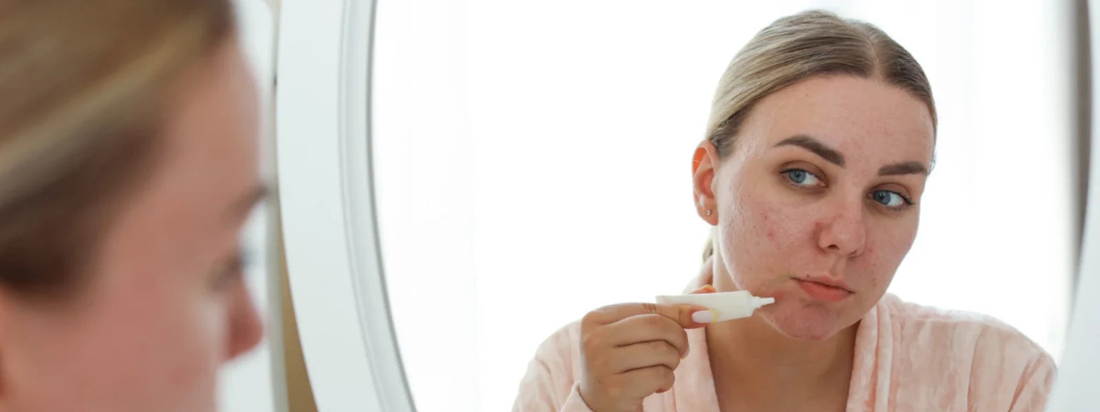 Skin Type & Acne Marks: What You Must Know 