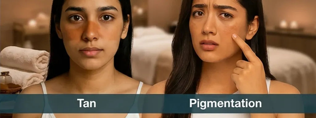 Tan vs Pigmentation: Your Complete Skin Guide 